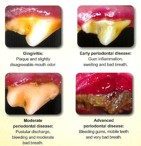 Treatment, Causes, Varieties, Early Signs & Signs